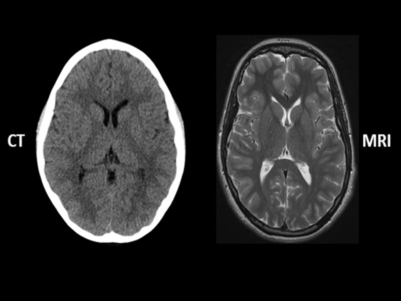 تفاوت ام آر آی و سی تی اسکن / MRI vs CT