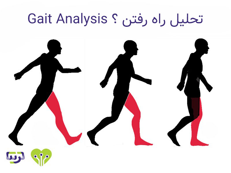 آنالیز راه رفتن / Gait analysis
