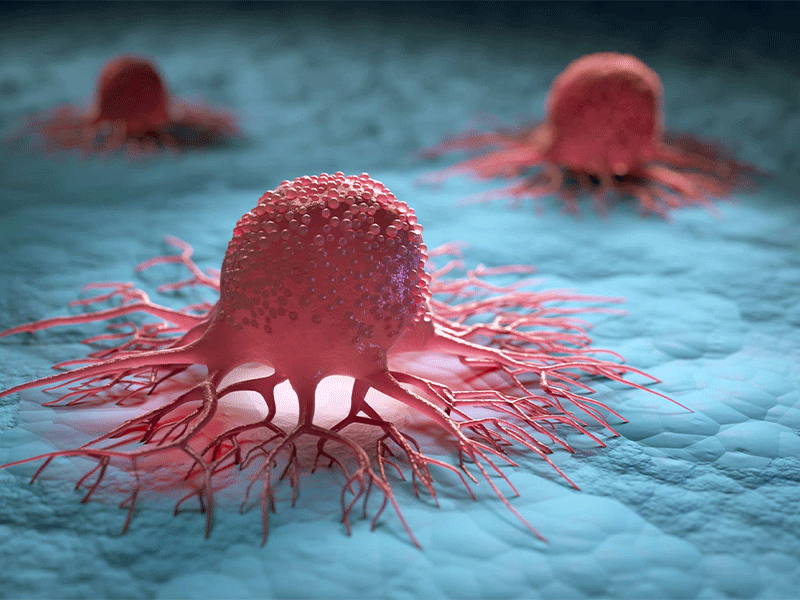 تشکیل سلول سرطانی / cancer cell formation