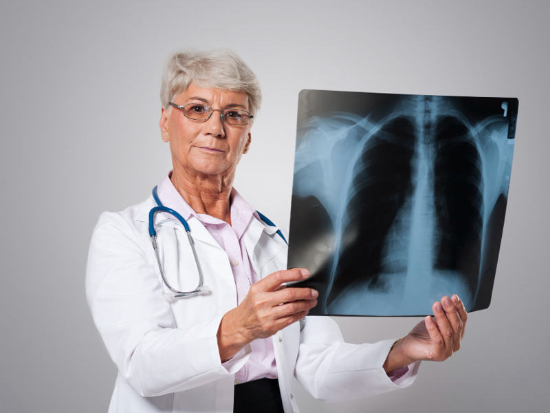 تصویر پزشکی ریه/ lung medical Image