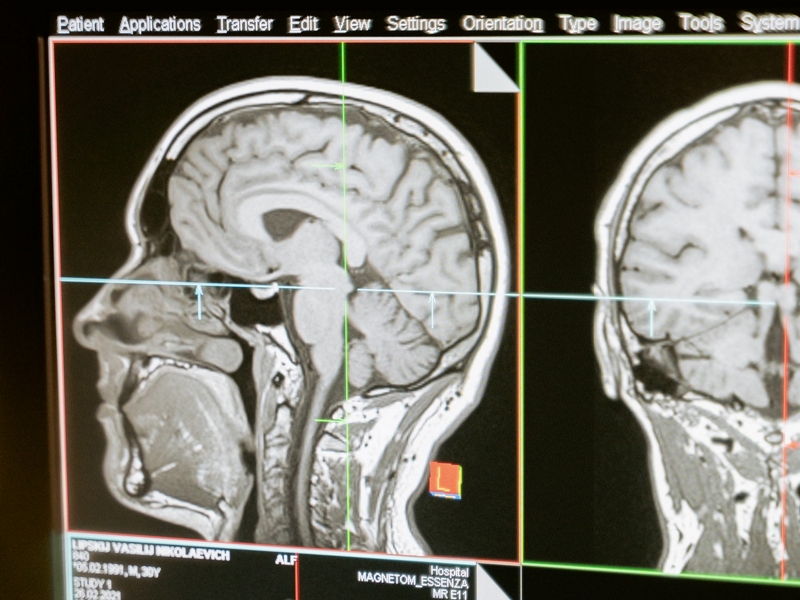 تصویر پرشکی مغز/medical image of brain