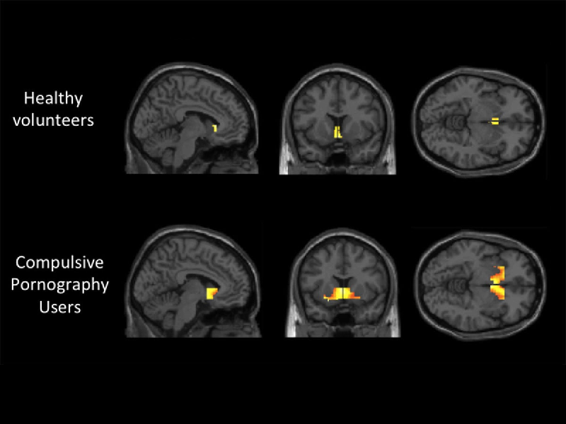 تاثیر پورن بر مغز - pornography effects on the brain - تریتا
