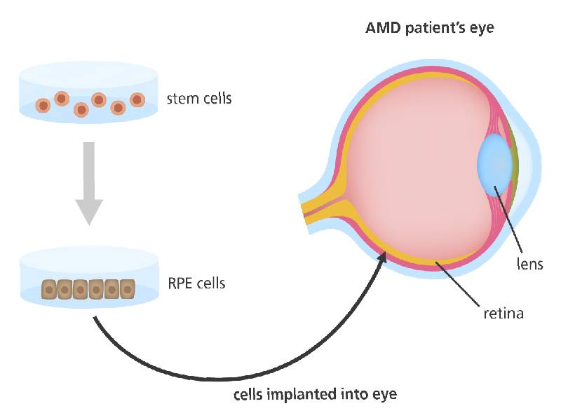 stem cell/سلول‌های بنیادی