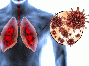 علائم درگیری ریه در کرونا/ Symptoms of lung involvement in corona