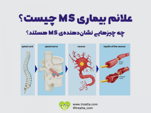 بیماری ام اس/MS Disease