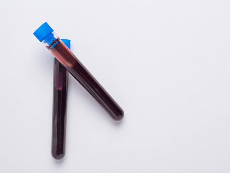 آزمایش خون/blood test