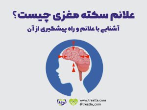 علائم سکته مغزی | stroke symptoms