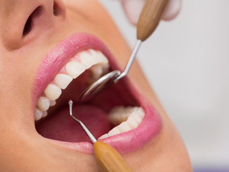 جراحی دندان/dental surgery