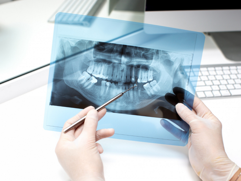 تصویربرداری از دندان/dental radiography