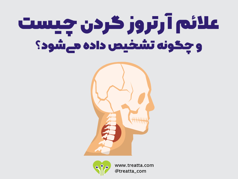 علائم آرتروز گردن / Cervical spondylosis symptoms