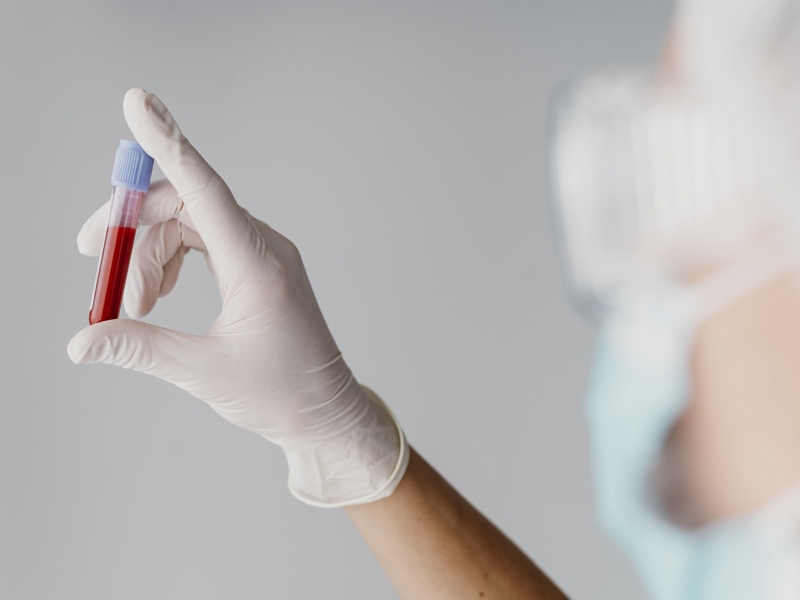 آزمایش خون / blood test