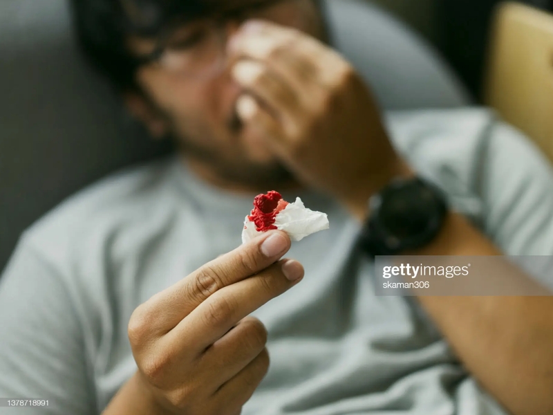 خون دماغ شدن |‌ nosebleeding